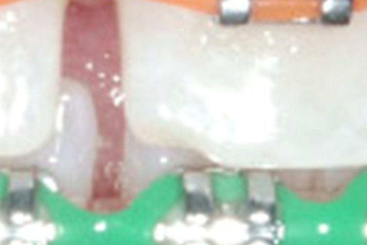 Kids Orthodontics